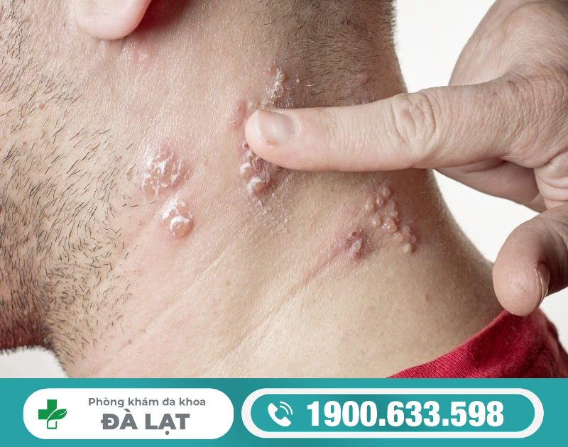 Hình ảnh minh họa